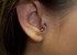 Tragus inflamado 1