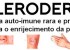 Esclerodermia 2