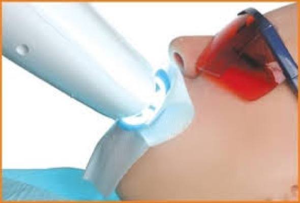 2-clareamento dental