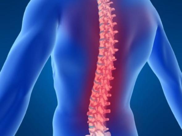 1-motivos dores nas costas postura