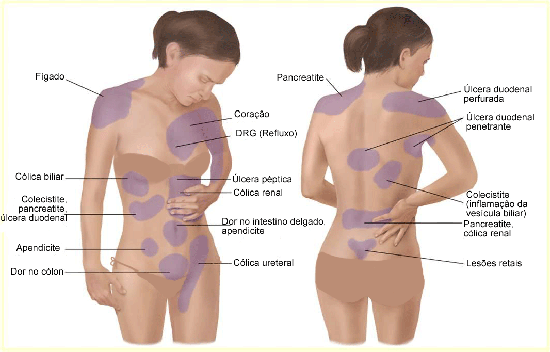 3-motivos dores nas costas postura