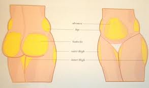 Lipoescultura x Lipoaspiracao