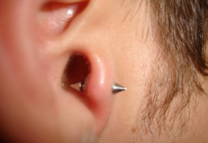 Tragus Inflamado: O que fazer para curar 4