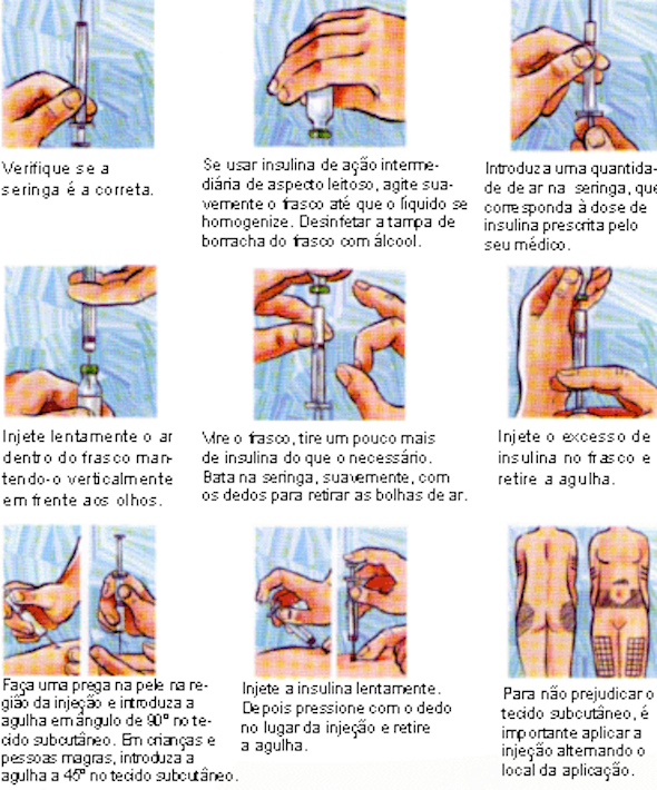 como+aplicar+insulina+corretamente4